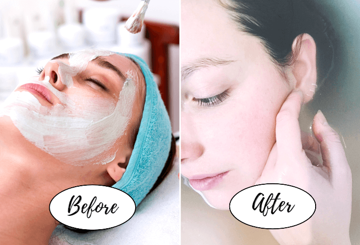 Vorher-Nachher-Effekt für Marketing