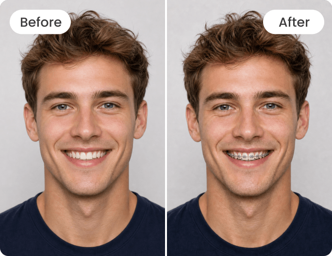 Add realistic braces to a boy photo