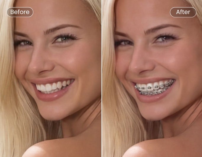 Challenged braces filter added photo before vs after