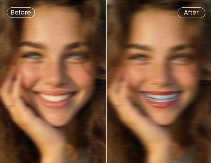 Failed braces filter added photo before vs after