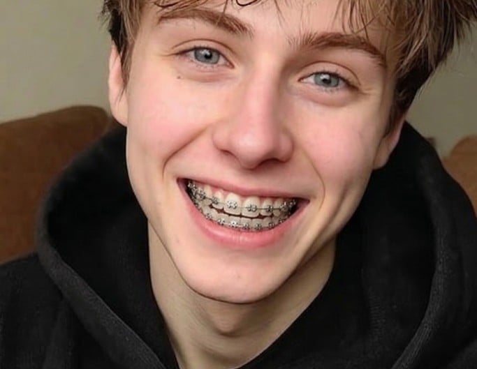 Metal braces on a boy for filter example photo