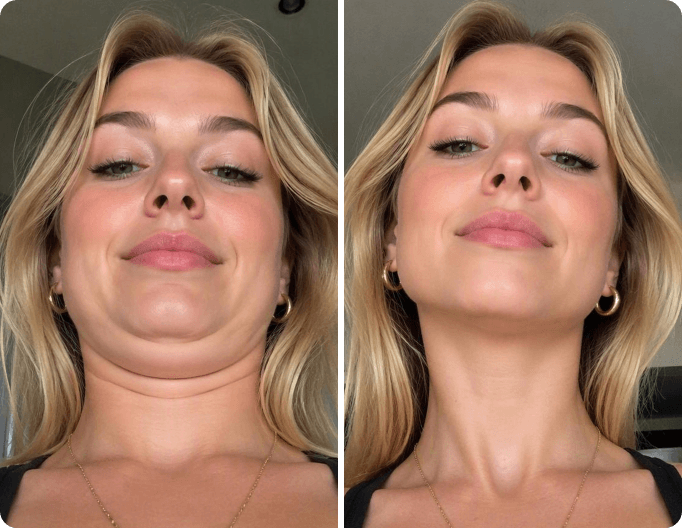 Remove double chin from a female selfie