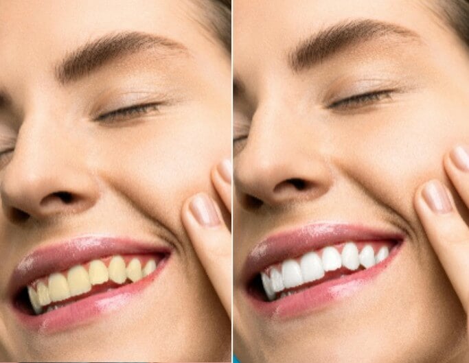 Whiten teeth in photo