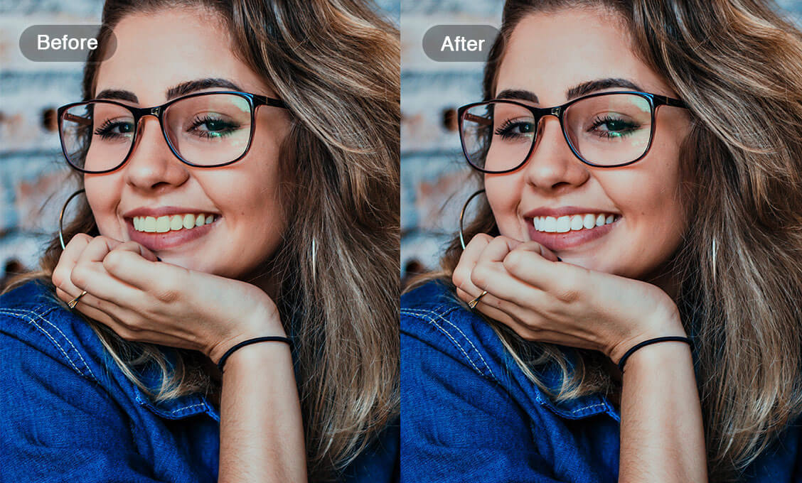 Fonction de comparaison beauté dents propres