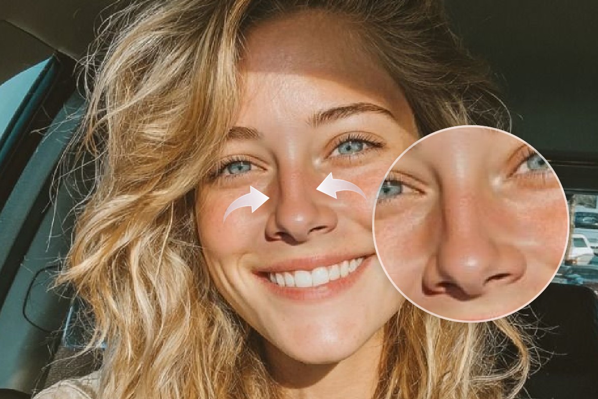 Fotor nose job simulator after banner image