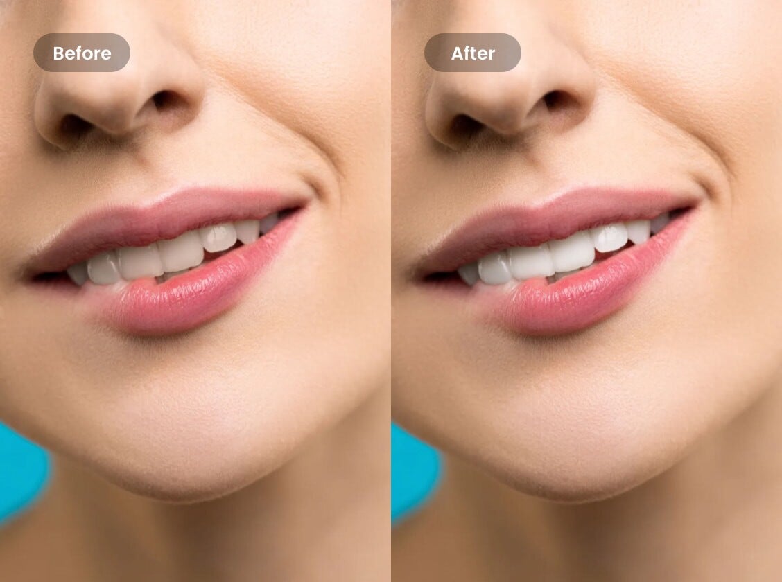 Teeth Whitening: Whiten Teeth in Photos Online for Free | Fotor Photo Editor