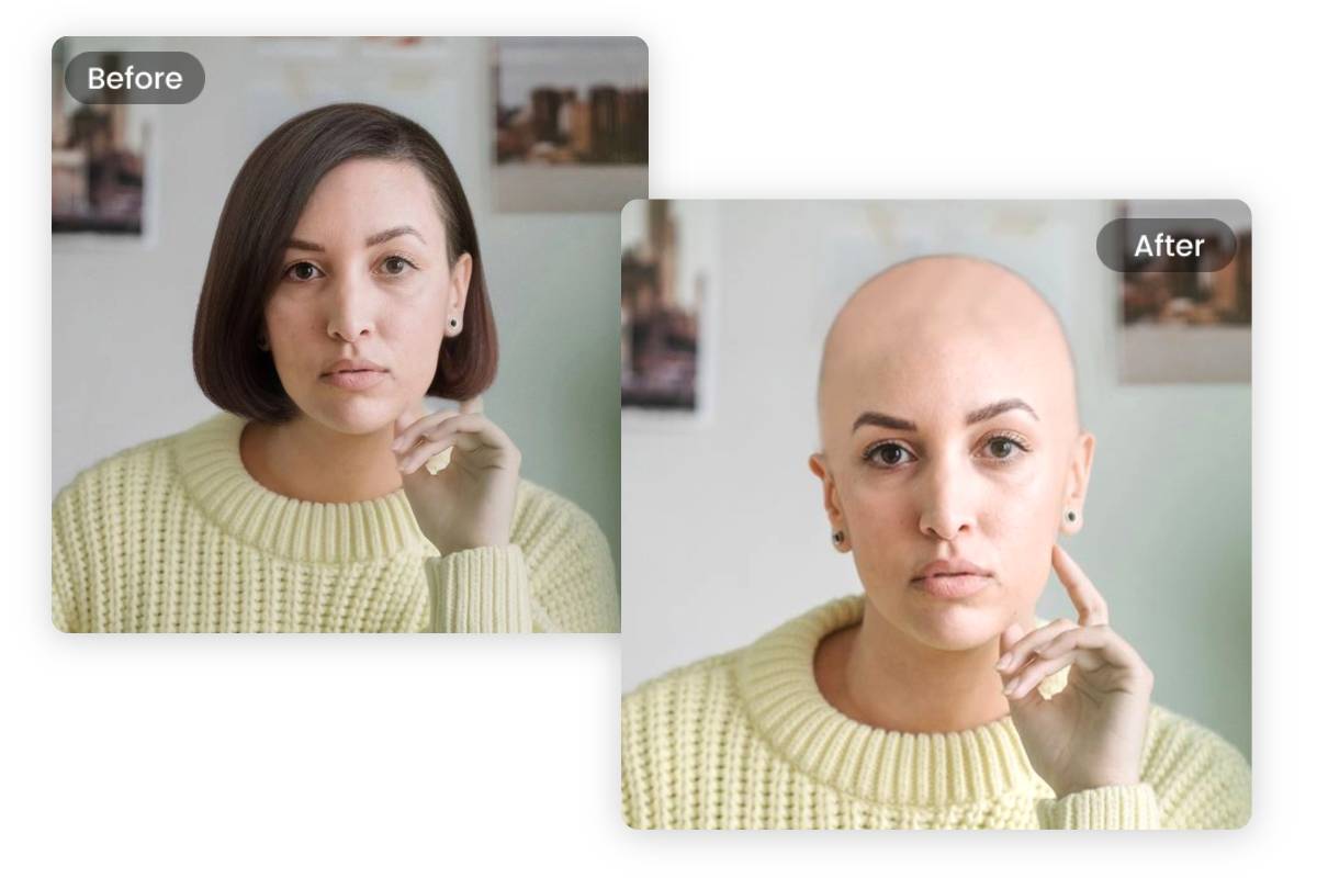 Hair loss in women: Celebrities speak of the pain of going bald | Life