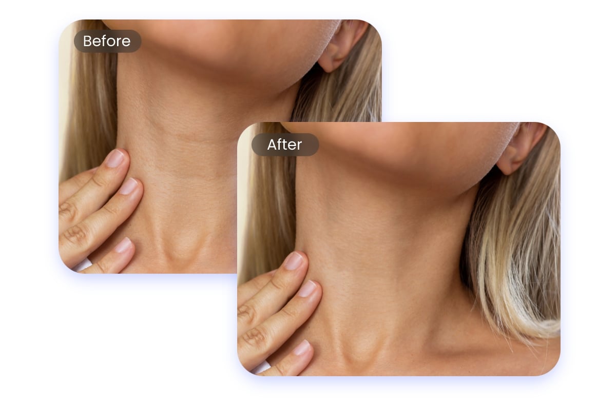 Remove neck wrinkles in a photo