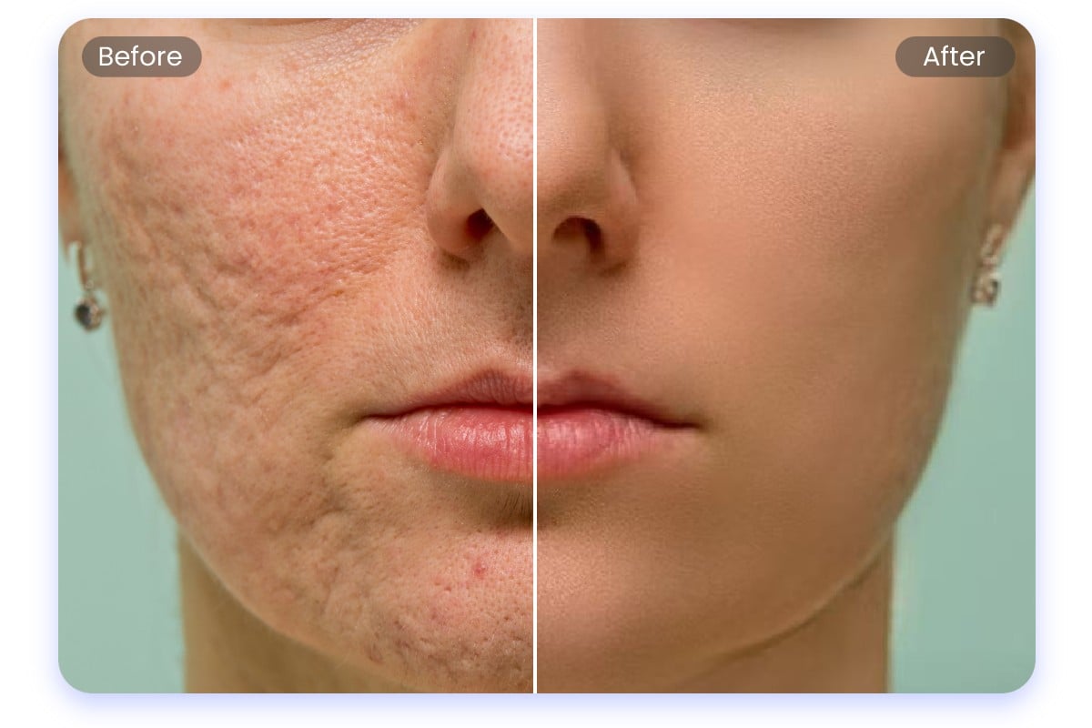 Smoothing skin naturally with AI face editing tools