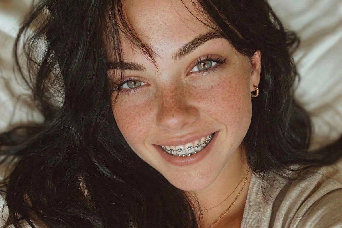 Girl photo after apply braces filter