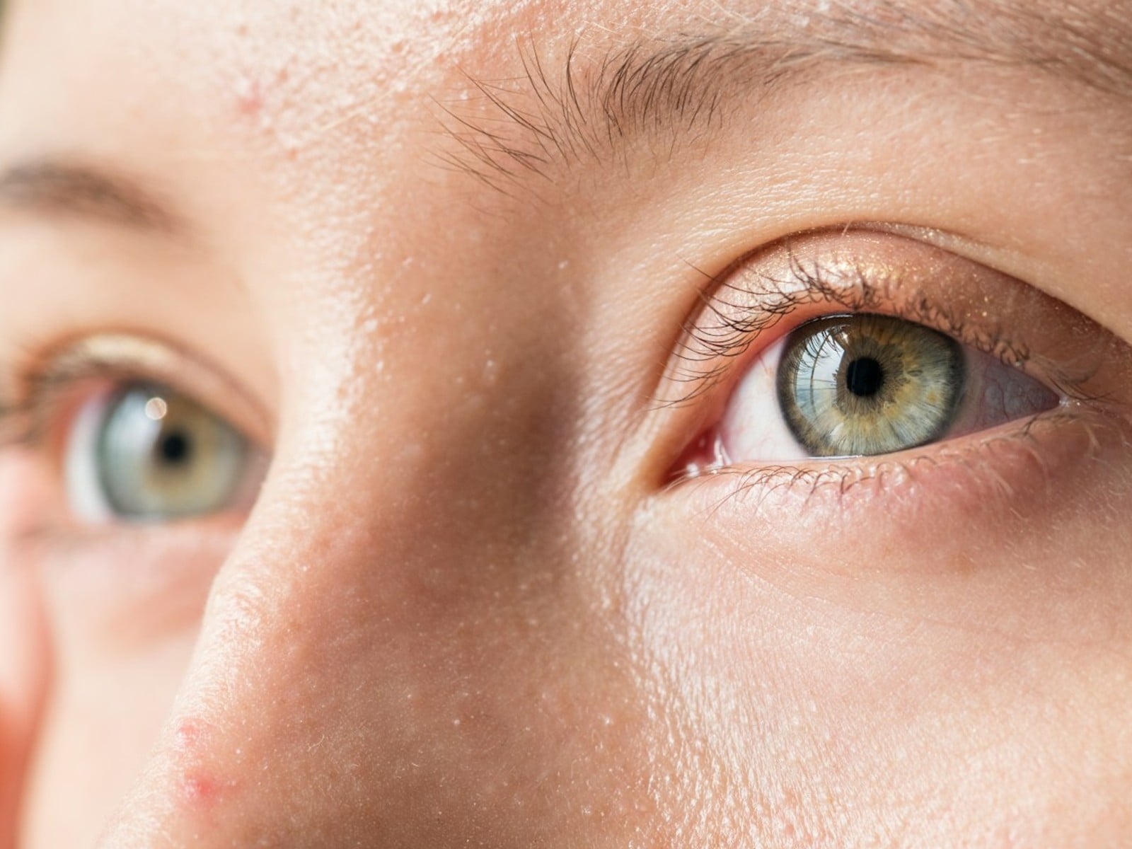 Red eyes before after removed picture
