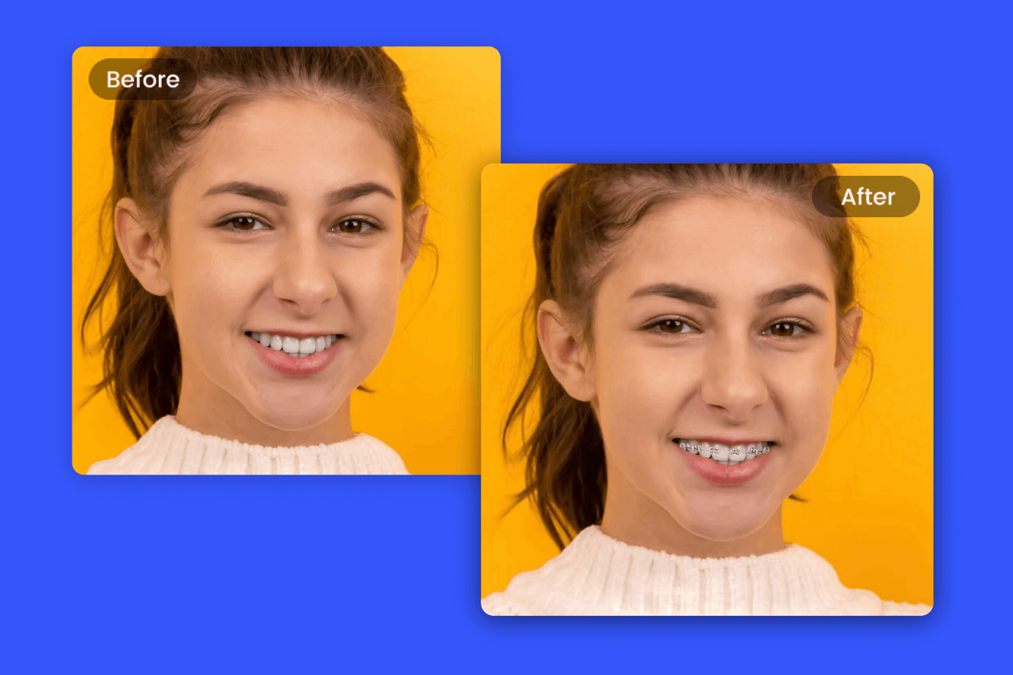 Straight Teeth Generator : See Your Smile