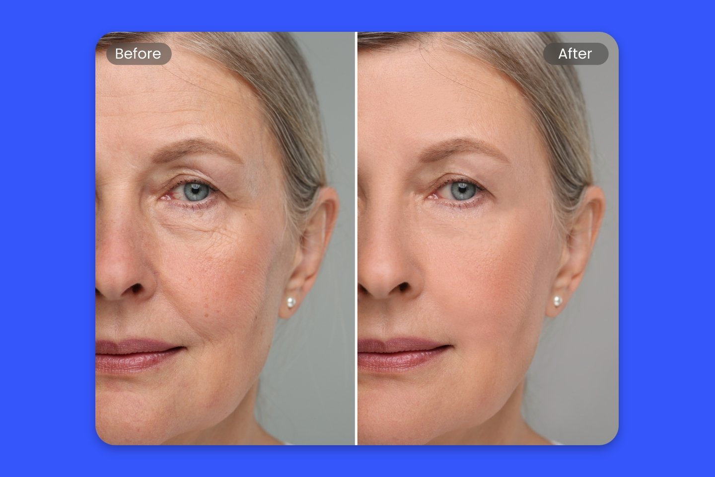 Remove the facial wrinkles from a photo of a woman in fotor